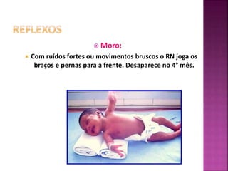  Moro:
 Com ruídos fortes ou movimentos bruscos o RN joga os
braços e pernas para a frente. Desaparece no 4° mês.
 