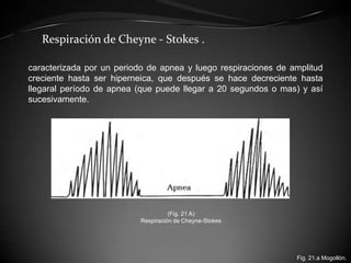 Respiración de Cheyne - Stokes .

caracterizada por un periodo de apnea y luego respiraciones de amplitud
creciente hasta ...