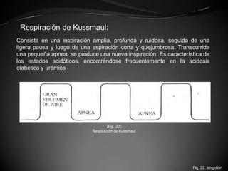 Respiración de Kussmaul:
Consiste en una inspiración amplia, profunda y ruidosa, seguida de una
ligera pausa y luego de un...