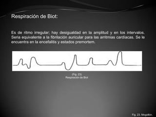 Respiración de Biot:


Es de ritmo irregular; hay desigualdad en la amplitud y en los intervalos.
Seria equivalente a la f...