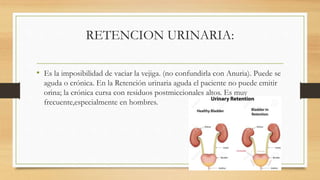 RETENCION URINARIA:
• Es la imposibilidad de vaciar la vejiga. (no confundirla con Anuria). Puede se
aguda o crónica. En la Retención urinaria aguda el paciente no puede emitir
orina; la crónica cursa con residuos postmiccionales altos. Es muy
frecuente,especialmente en hombres.
 