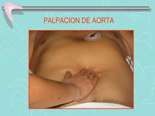 PALPACION DE AORTA
 