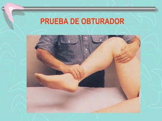 PRUEBA DE OBTURADOR
 