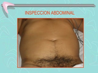 INSPECCION ABDOMINAL
 