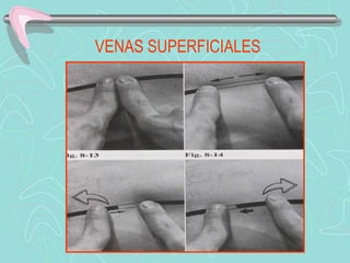 VENAS SUPERFICIALES
 