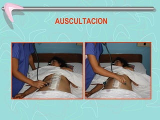 AUSCULTACION
 