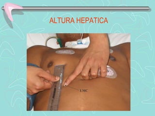 ALTURA HEPATICA




       LMC
 