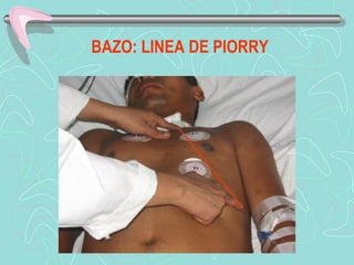 BAZO: LINEA DE PIORRY
 