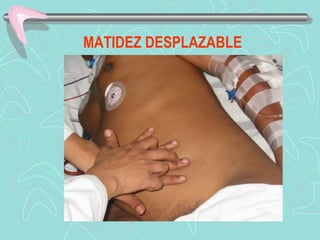 MATIDEZ DESPLAZABLE
 