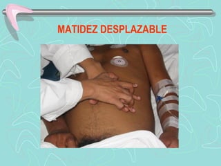 MATIDEZ DESPLAZABLE
 