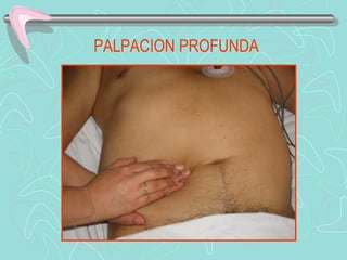 PALPACION PROFUNDA
 