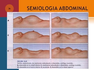 SEMIOLOGIA ABDOMINAL36