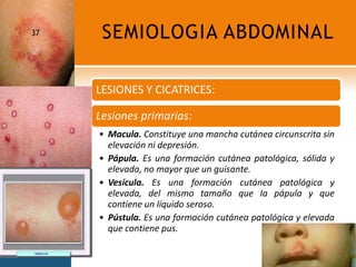 SEMIOLOGIA ABDOMINAL37