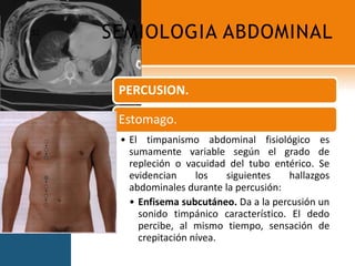 SEMIOLOGIA ABDOMINAL52