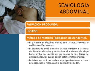 SEMIOLOGIA ABDOMINAL68