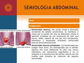 SEMIOLOGIA ABDOMINAL97