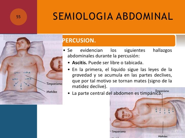 Semiologia abdominal.