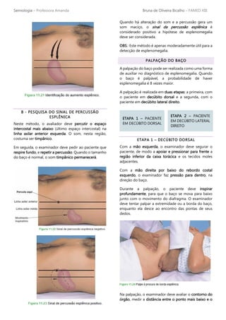 Semiologia – Professora Amanda Bruna de Oliveira Bicalho – FAMED XIII
B - PESQUISA DO SINAL DE PERCUSSÃO
ESPLÊNICA
Neste método, o avaliador deve percutir o espaço
intercostal mais abaixo (último espaço intercostal) na
linha axilar anterior esquerda. O som, nesta região,
costuma ser timpânico.
Em seguida, o examinador deve pedir ao paciente que
respire fundo, e repetir a percussão. Quando o tamanho
do baço é normal, o som timpânico permanecerá.
Quando há alteração do som e a percussão gera um
som maciço, o sinal da percussão esplênica é
considerado positivo a hipótese de esplenomegalia
deve ser considerada.
OBS.: Este método é apenas moderadamente útil para a
detecção de esplenomegalia.
PALPAÇÃO DO BAÇO
A palpação do baço pode ser realizada como uma forma
de auxiliar no diagnóstico de esplenomegalia. Quando
o baço é palpável, a probabilidade de haver
esplenomegalia é 8 vezes maior.
A palpação é realizada em duas etapas: a primeira, com
o paciente em decúbito dorsal e a segunda, com o
paciente em decúbito lateral direito.
ETAPA 1 – DECÚBITO DORSAL
Com a mão esquerda, o examinador deve segurar o
paciente, de modo a apoiar e pressionar para frente a
região inferior da caixa torácica e os tecidos moles
adjacentes.
Com a mão direita por baixo do rebordo costal
esquerdo, o examinador faz pressão para dentro, na
direção do baço.
Durante a palpação, o paciente deve inspirar
profundamente, para que o baço se mova para baixo
junto com o movimento do diafragma. O examinador
deve tentar palpar a extremidade ou a borda do baço,
enquanto ela desce ao encontro das pontas de seus
dedos.
Na palpação, o examinador deve avaliar o contorno do
órgão, medir a distância entre o ponto mais baixo e o
ETAPA 1 – PACIENTE
EM DECÚBITO DORSAL
ETAPA 2 – PACIENTE
EM DECÚBITO LATERAL
DIREITO
 