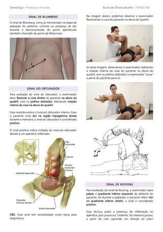 Semiologia – Professora Amanda Bruna de Oliveira Bicalho – FAMED XIII
SINAL DE BLUMBERG
O sinal de Blumberg, como já mencionado na etapa de
palpação do abdome, consiste na presença de dor
durante a descompressão do ponto apendicular
(também chamado de ponto de Mcburney).
SINAL DO OBTURADOR
Para avaliação do sinal do obturador, o examinador
deve flexionar a coxa direita do paciente na altura do
quadril, com os joelhos dobrados, efetuando rotação
interna da coxa na altura do quadril.
Essa manobra estira o músculo obturador interno. Caso
o paciente sinta dor na região hipogástrica direita
durante a manobra, o sinal do obturador é considerado
positivo.
O sinal positivo indica irritação do músculo obturador
devido a um apêndice inflamado.
OBS.: Esse sinal tem sensibilidade muito baixa para
diagnóstico.
Na imagem abaixo, podemos observar o examinador
flexionando a coxa do paciente na altura do quadril:
Já nesta imagem, observamos o examinador realizando
a rotação interna da coxa do paciente na altura do
quadril, com os joelhos dobrados (o examinador “puxa”
a perna do paciente para si):
SINAL DE ROVSING
Para avaliação do sinal de Rovsing, o examinador deve
palpar o quadrante inferior esquerdo do abdome do
paciente. Se durante a palpação, o paciente referir dor
no quadrante inferior direito, o sinal é considerado
positivo.
Essa técnica avalia a presença de inflamação no
apêndice, pois provoca a “ordenha” do intestino grosso,
a partir do colo sigmoide, em direção ao cólon
 
