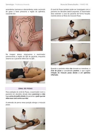 Semiologia – Professora Amanda Bruna de Oliveira Bicalho – FAMED XIII
ascendente, transverso e descendente, onde o acúmulo
de gases e fezes pressiona a região do apêndice,
causando dor.
Na imagem abaixo, observamos o examinador
pressionando a região do QIE do paciente, enquanto
observa se o paciente refere dor no QID.
SINAL DO PSOAS
Para avaliação do sinal do Psoas, o examinador (com o
paciente em decúbito dorsal) deve posicionar a mão
logo acima do joelho direito do paciente e pedir que ele
eleve essa coxa contra sua mão.
A extensão da perna nessa posição alonga o músculo
psoas.
O sinal do Psoas também pode ser investigado com o
paciente em decúbito lateral esquerdo. O examinador
deve estender a coxa do paciente de forma forçada,
visando estirar as fibras do músculo Psoas.
Quando o paciente refere dor durante as manobras, o
sinal de psoas é considerado positivo, o que sugere
irritação do músculo psoas devido a um apêndice
inflamado.
 