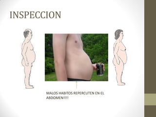 MALOS HABITOS REPERCUTEN EN EL
ABDOMEN!!!!
INSPECCION
 