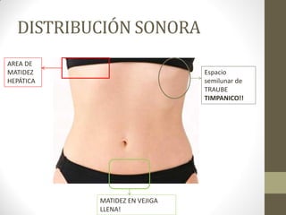 DISTRIBUCIÓN SONORA
Espacio
semilunar de
TRAUBE
TIMPANICO!!
AREA DE
MATIDEZ
HEPÁTICA
MATIDEZ EN VEJIGA
LLENA!
 