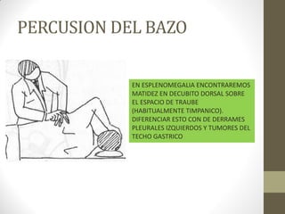 PERCUSION DEL BAZO
EN ESPLENOMEGALIA ENCONTRAREMOS
MATIDEZ EN DECUBITO DORSAL SOBRE
EL ESPACIO DE TRAUBE
(HABITUALMENTE TIMPANICO).
DIFERENCIAR ESTO CON DE DERRAMES
PLEURALES IZQUIERDOS Y TUMORES DEL
TECHO GASTRICO
 