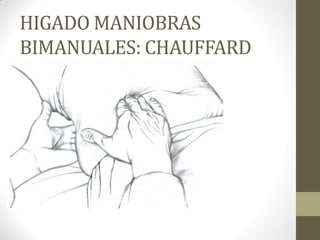 HIGADO MANIOBRAS
BIMANUALES: CHAUFFARD
 