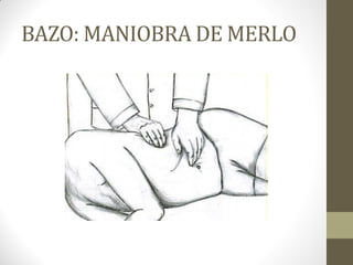 BAZO: MANIOBRA DE MERLO
 