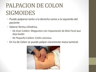 PALPACION DE COLON
SIGMOIDES
• Puede palparse tanto a la derecha como a la izquierda del
paciente
• Valorar forma cilíndrica.
• De Gran Calibre: Megacolon con impactación de Bolo Fecal que
deja Godet
• De Pequeño Calibre: Colitis ulcerosa
• En Ca de Colon se puede palpar claramente masa tumoral
 