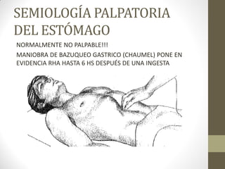 SEMIOLOGÍA PALPATORIA
DEL ESTÓMAGO
NORMALMENTE NO PALPABLE!!!
MANIOBRA DE BAZUQUEO GASTRICO (CHAUMEL) PONE EN
EVIDENCIA RHA HASTA 6 HS DESPUÉS DE UNA INGESTA
 