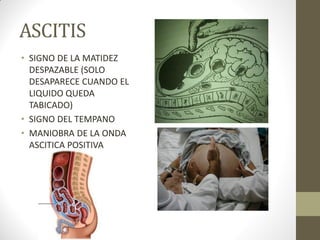 ASCITIS
• SIGNO DE LA MATIDEZ
DESPAZABLE (SOLO
DESAPARECE CUANDO EL
LIQUIDO QUEDA
TABICADO)
• SIGNO DEL TEMPANO
• MANIOBRA DE LA ONDA
ASCITICA POSITIVA
 
