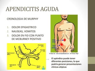 APENDICITIS AGUDA
CRONOLOGIA DE MURPHY
1. DOLOR EPIGASTRICO
2. NAUSEAS, VOMITOS
3. DOLOR EN FID CON PUNTO
DE MCBURNEY POSITIVO
El apéndice puede tener
diferentes posiciones, lo que
podría generar presentaciones
clínicas atípicas
 