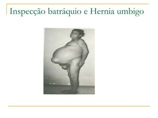 Inspecção batráquio e Hernia umbigo
 