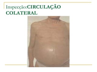 Inspecção:CIRCULAÇÃO
COLATERAL
 
