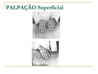 PALPAÇÃO Superficial
 