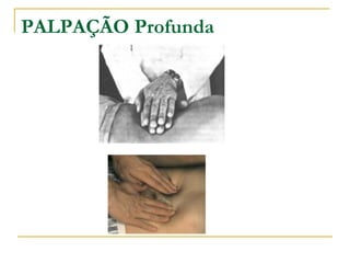 PALPAÇÃO Profunda
 