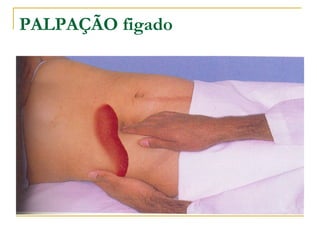 PALPAÇÃO figado
 