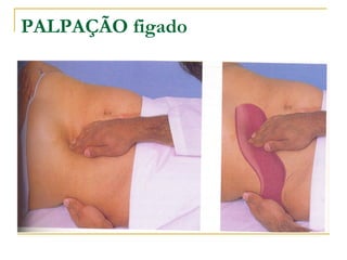 PALPAÇÃO figado
 
