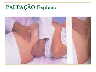 PALPAÇÃO Esplena
 