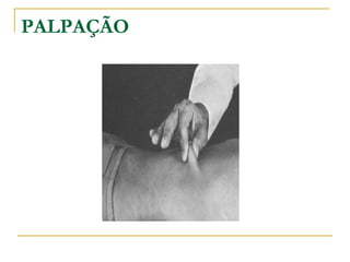 PALPAÇÃO
 