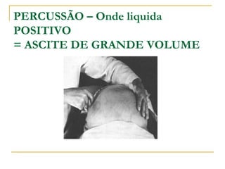 PERCUSSÃO – Onde liquida
POSITIVO
= ASCITE DE GRANDE VOLUME
 