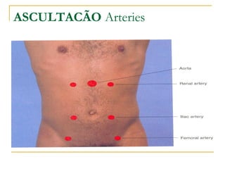 ASCULTACÃO Arteries
 