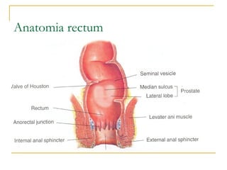 Anatomia rectum
 