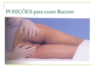 POSIÇÕES para exam Rectum
 