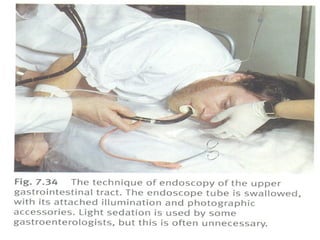 Semiologia abdominal final