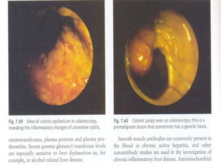 Semiologia abdominal final