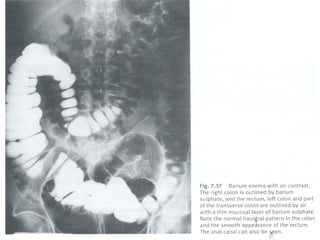 Semiologia abdominal final