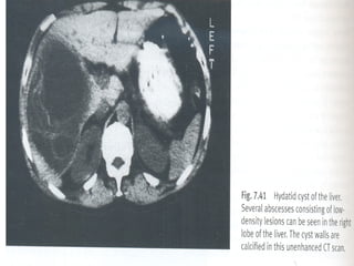 Semiologia abdominal final