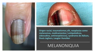 MELANONIQUIA
Origen racial, traumatismos,vih, neoplasias como
melanomas, medicamentos ( antipalúdicos,
zidovudina, antineoplásicos), syndrome de Adison,
Peutz Jeghers, Laugier Hunziker
 